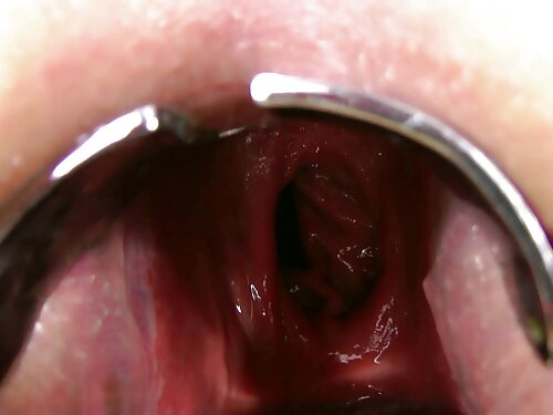 El tipo de la pimien ...